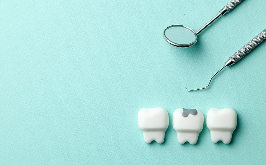 虫歯の原因と治療のリスク