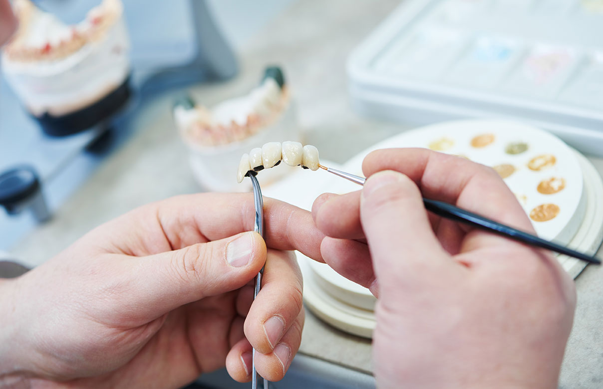 見た目も機能性も優れた補綴物 熟練の技術力をもつ歯科技工士と連携