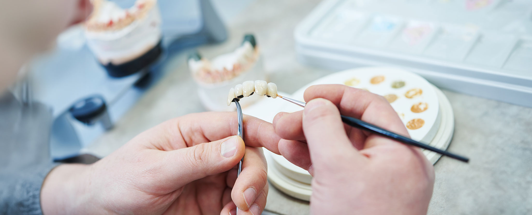 見た目も機能性も優れた補綴物　熟練の技術力をもつ歯科技工士と連携
